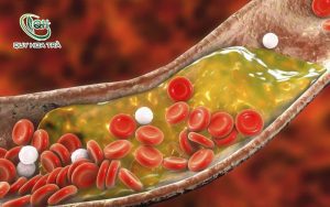 Cần hiểu Cholesterol như thế nào?