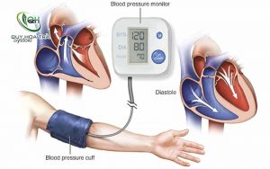 Người bị huyết áp cao nên ăn gì?